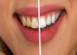 Ashamed of Yellow Teeth? Whiten Them Easily at Home