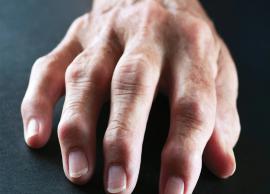 7 Home Remedies That Can Help Manage the Symptoms of Rheumatoid Arthritis