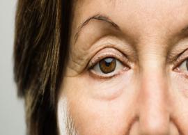 6 Effective Home Remedies for Sagging Eyelids
