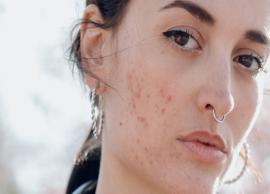 6 Skin Problems That Indicate Severe Health Conditions