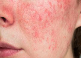 5 Habits That Increases The Chances of Skin Infection