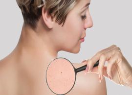 6 Natural Ways To Avoid All Kind of Skin Problem