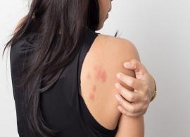 5 Common Skin Problems Listed Here