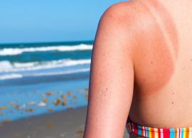 5 Home Remedies To Treat Skin Sunburn