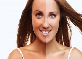 5 Natural Ways To Get Rid of Skin Tanning