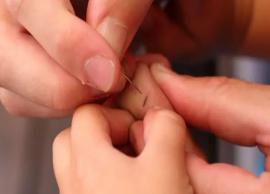 5 Simple Ways of Removing Splinter at Home