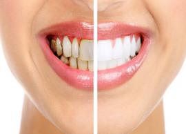 5 Home Remedies To Remove Stains From Teeth