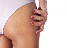 4 Exercises To Help You Get Rid of Stretch Marks