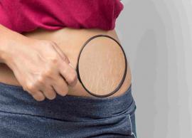 6 Myths About Stretch Marks You Should Not Believe