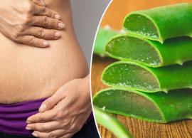 6 Home Remedies You Can Try To Treat Stretch Marks