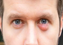 Here are Some Ways You Can Prevent and Get Rid of Styes in Your Eyes