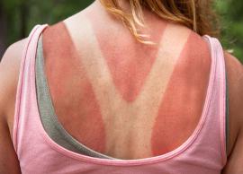 Home Remedies for Treating and Alleviating Sunburn