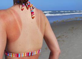 2 Effective Home Remedies to Treat Sunburn at Home