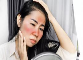 7 Most Common Home Remedies To Use for Sunburn on Face
