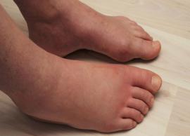 6 Effective Home Remedies for Swollen Feet And Ankle