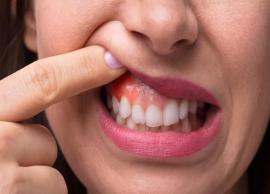 Useful Home Remedies For Swollen Gums