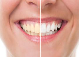 5 Reasons Why Your Teeth are Turning Yellow