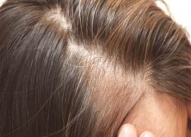 6 Home Remedies To Treat Thinning Hair