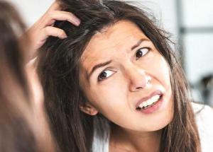 5 Instant Ways To Get Rid of Dandruff