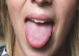 6 Different Types of Diseases That are Reflected With Tongue Color