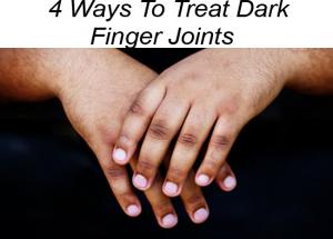 4 Ways To Treat Dark Finger Joints