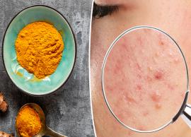 8 Turmeric Face Mask To Get Rid of Pimples