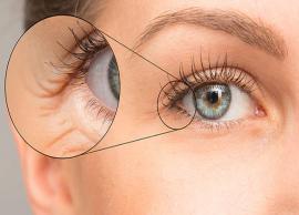 5 Remedies To Get Rid of Under Eye Wrinkles at Home
