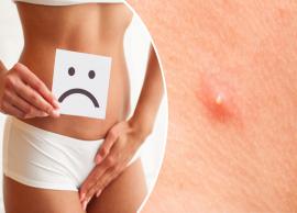 4 Most Common Causes of Vaginal Pimples
