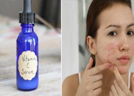 DIY Vitamin C Serum To Treat Acne Scars