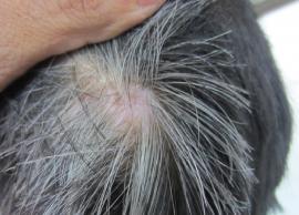 10 DIY Effective Home Remedies To Get Rid Of White Hair Naturally