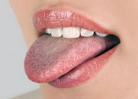 5 Home Remedies To Get Rid of White Tongue