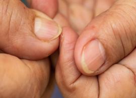 4 Natural Remedies To Treat Yellow Nails