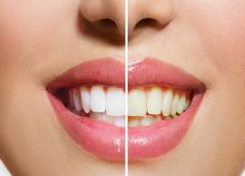 5 Easy Ways To Get Rid of Yellow Teeth