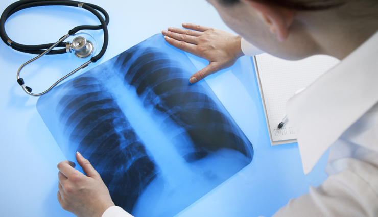 exercise,health benefits,Health tips,legs exercise,simple health tips