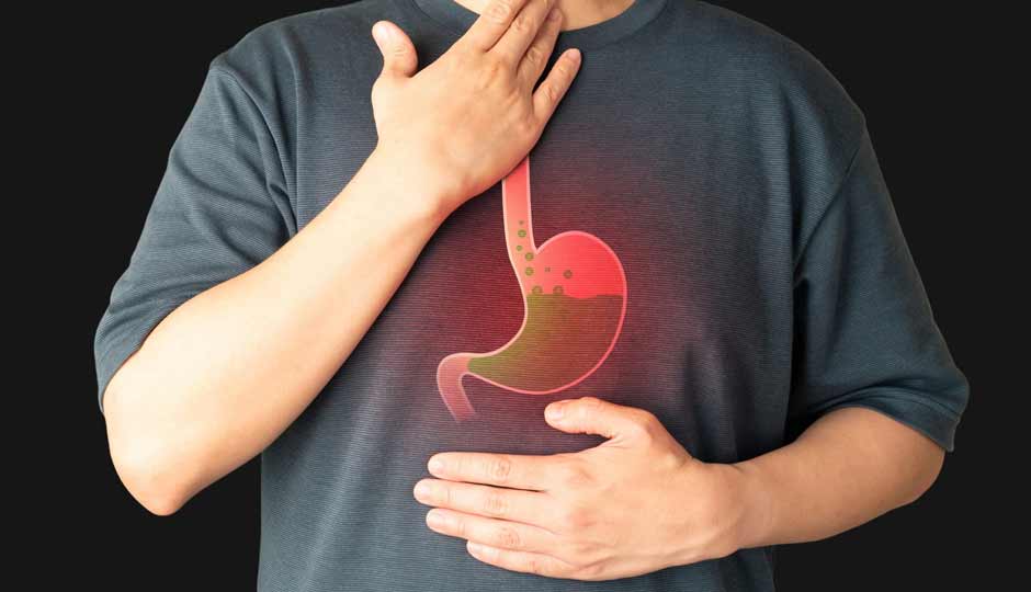 15 Home Remedies to Treat Indigestion Naturally