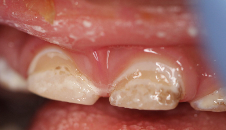 risks of kissing a baby,dangers of kissing babies,health risks of kissing newborns,parental awareness: risks of kissing a baby,potential dangers of kissing infants,baby health hazards: kissing precautions,kissing babies: health risks parents should know,importance of being aware of kissing risks for parents,baby safety: risks associated with kissing,protecting your baby: understanding the risks of kissing