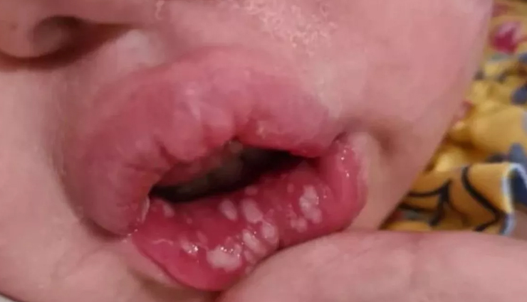 risks of kissing a baby,dangers of kissing babies,health risks of kissing newborns,parental awareness: risks of kissing a baby,potential dangers of kissing infants,baby health hazards: kissing precautions,kissing babies: health risks parents should know,importance of being aware of kissing risks for parents,baby safety: risks associated with kissing,protecting your baby: understanding the risks of kissing