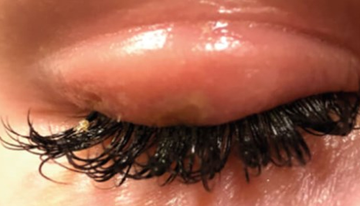 eyelash extension side effects,beware of eyelash extension risks,potential problems with lash extensions,adverse effects of using lash extensions,eyelash extensions and their drawbacks,negative consequences of lash extension use,health concerns with eyelash extensions,side effects of prolonged lash extension use,risks of wearing eyelash extensions,eyelash extension complications to watch out for