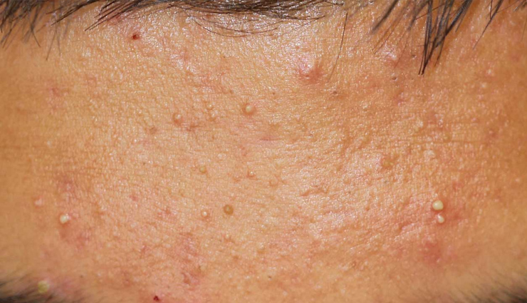 jojoba oil,jojoba oil benefits,jojoba oil for skin,jojoba oil for hair,skin care tips,skin care,hair,hair care tips,beauty,beauty tips