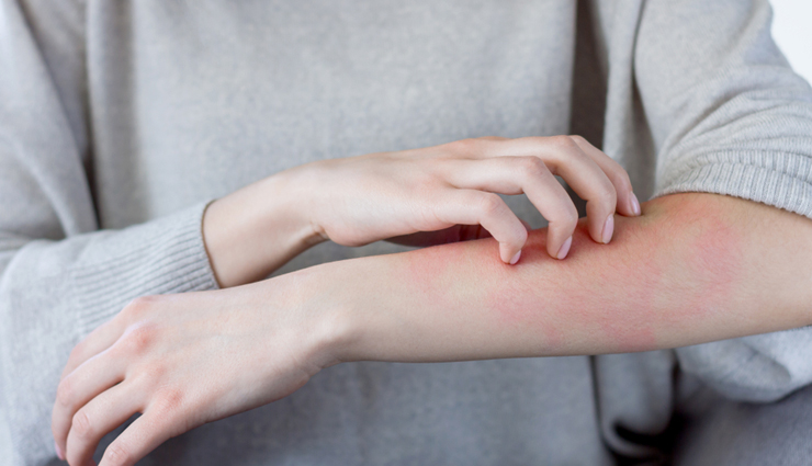 6 Anti- Inflammatory Foods That Help To Fight Inflammation