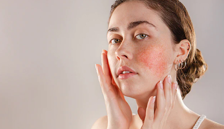 diy ways to use coconut oil to treat acne scars,beauty tips,beauty hacks