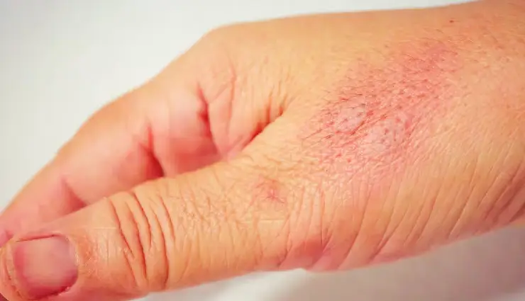 artificial sweeteners health risks,dangers of artificial sweeteners,artificial sweeteners and diabetes,sugar substitutes and obesity,artificial sweeteners side effects,health problems from diet sodas,risks of low calorie sweeteners,artificial sweeteners and heart disease,harmful effects of sugar substitutes,why artificial sweeteners are bad