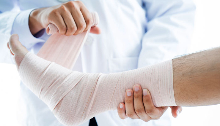 gout,home remedies for gout,gout treatment,gout home remedies,home remedies to treat gout,Health,Health tips