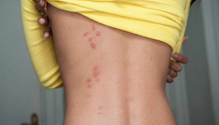 home remedies for common ailments,natural remedies for cough,sore throat home remedies,headache relief remedies,upset stomach remedy,home remedy for burns,natural insect bite treatment,ayurveda home remedies,ginger for cold,aloe vera for burns,turmeric for cuts,digestion home remedies,ayurvedic treatments,indian traditional healing,herbal remedies for health