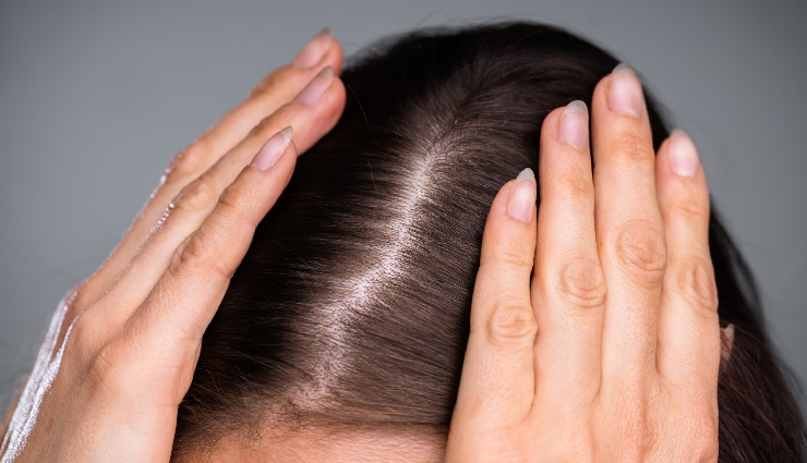 natural hair care tips,healthy hair routine,common hair care mistakes,hair care advice,long-term hair health,personalized hair care,natural remedies for hair,hair care do’s and don’ts,hair care for strong hair,hair maintenance tips