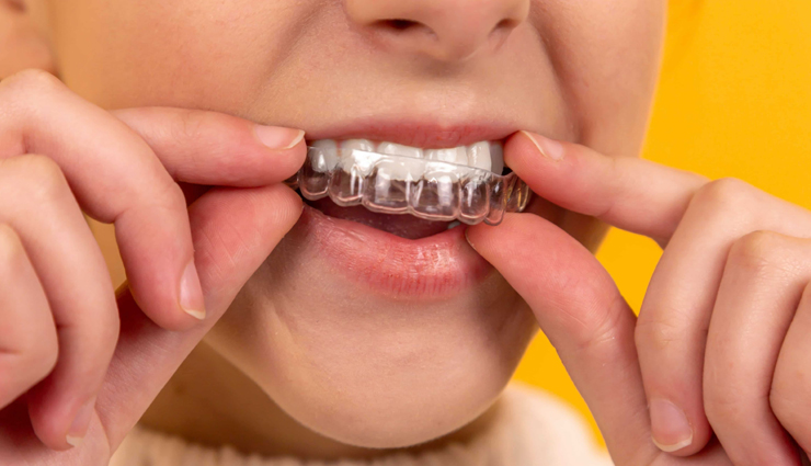 invisalign treatment,benefits of invisalign,invisalign braces,invisalign clear aligners,invisalign orthodontic treatment,invisalign for teeth alignment,invisalign vs traditional braces,how does invisalign work,invisalign process,invisalign consultation,invisalign maintenance,invisalign cleaning,invisalign cost,invisalign financing options,invisalign before and after,invisalign success stories,invisalign for adults,invisalign for teens,invisalign treatment tips