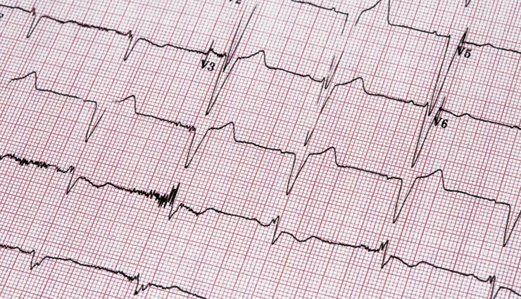 improve cardiovascular health,heart health tips,cardiovascular wellness,boost heart function,heart disease prevention,healthy heart lifestyle,enhance heart health