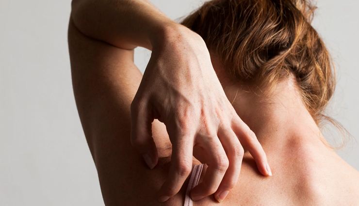 itching,remedies for itching,essential oils for itching,Health tips,fitness tips