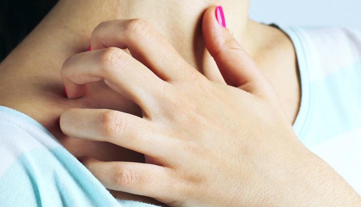 सर्दियों में होने वाली खुजली को दूर करने के कुछ खास उपाय home remedies,itching problem,winter,Health tips,hygiene life