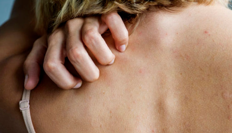 itching in private parts,home remedies,home remedies for itching in private parts,home remedies for itching on skin,itching on skin